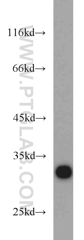 Western Blot (WB) analysis of K-562 cells using CDK2 Polyclonal antibody (10122-1-AP)