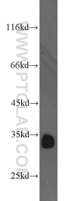 Western Blot (WB) analysis of HeLa cells using CDK2 Polyclonal antibody (10122-1-AP)