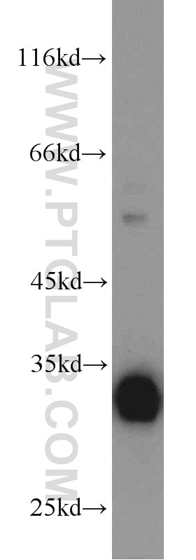 Western Blot (WB) analysis of HL-60 cells using CDK2 Polyclonal antibody (10122-1-AP)
