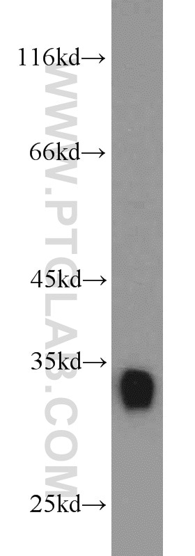 Western Blot (WB) analysis of Jurkat cells using CDK2 Polyclonal antibody (10122-1-AP)