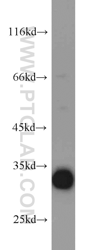 Western Blot (WB) analysis of HEK-293 cells using CDK2 Polyclonal antibody (10122-1-AP)