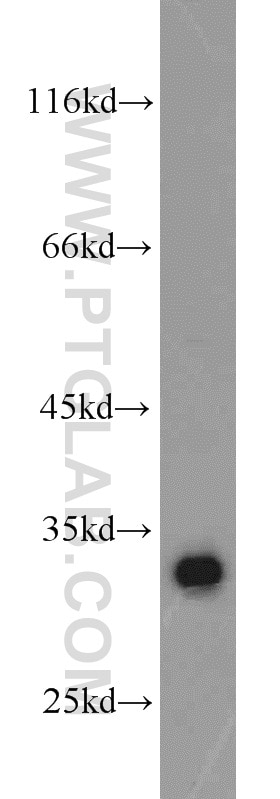 Western Blot (WB) analysis of A431 cells using CDK2 Polyclonal antibody (10122-1-AP)