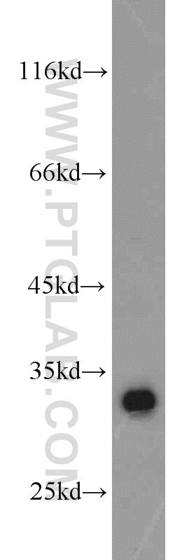 Western Blot (WB) analysis of A431 cells using CDK2 Polyclonal antibody (10122-1-AP)