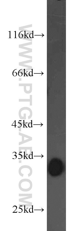 Western Blot (WB) analysis of K-562 cells using CDK2 Polyclonal antibody (10122-1-AP)