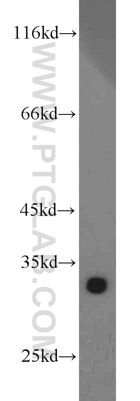 WB analysis of MCF-7 using 10122-1-AP