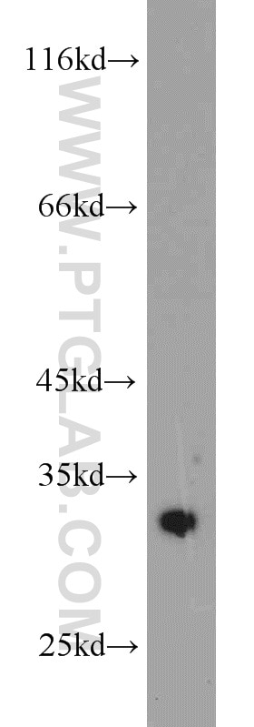 Western Blot (WB) analysis of NIH/3T3 cells using CDK2 Polyclonal antibody (10122-1-AP)