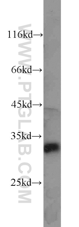 Western Blot (WB) analysis of rat kidney tissue using CDK2 Polyclonal antibody (10122-1-AP)