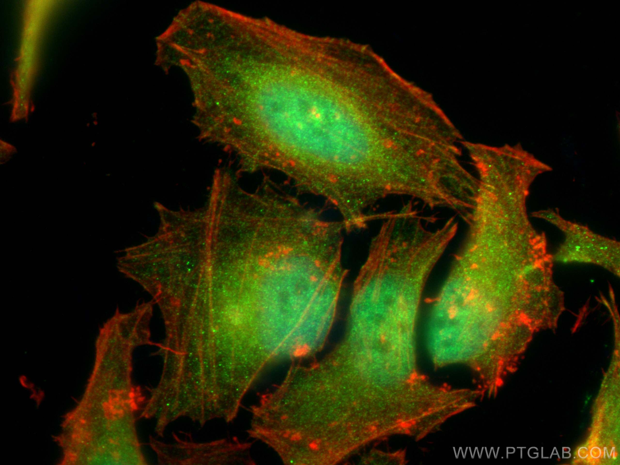 Immunofluorescence (IF) / fluorescent staining of HeLa cells using CDK2 Polyclonal antibody (22060-1-AP)