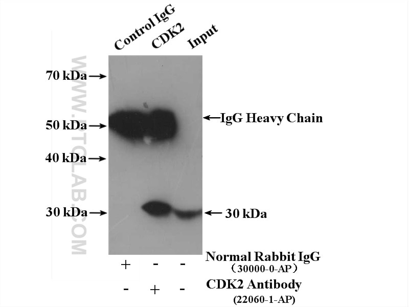 Immunoprecipitation (IP) experiment of K-562 cells using CDK2 Polyclonal antibody (22060-1-AP)