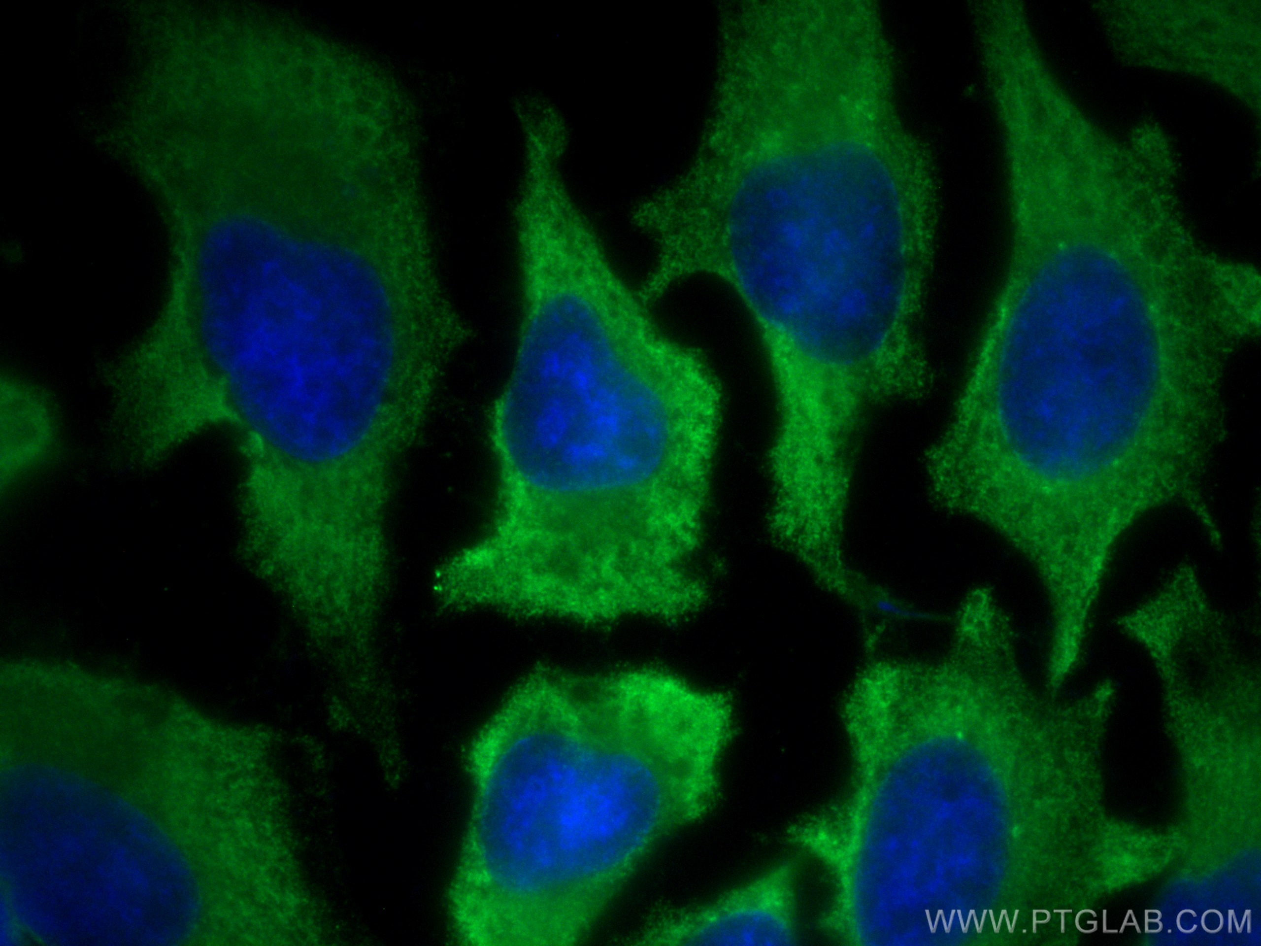 Immunofluorescence (IF) / fluorescent staining of HeLa cells using CDK2 Monoclonal antibody (60312-1-Ig)
