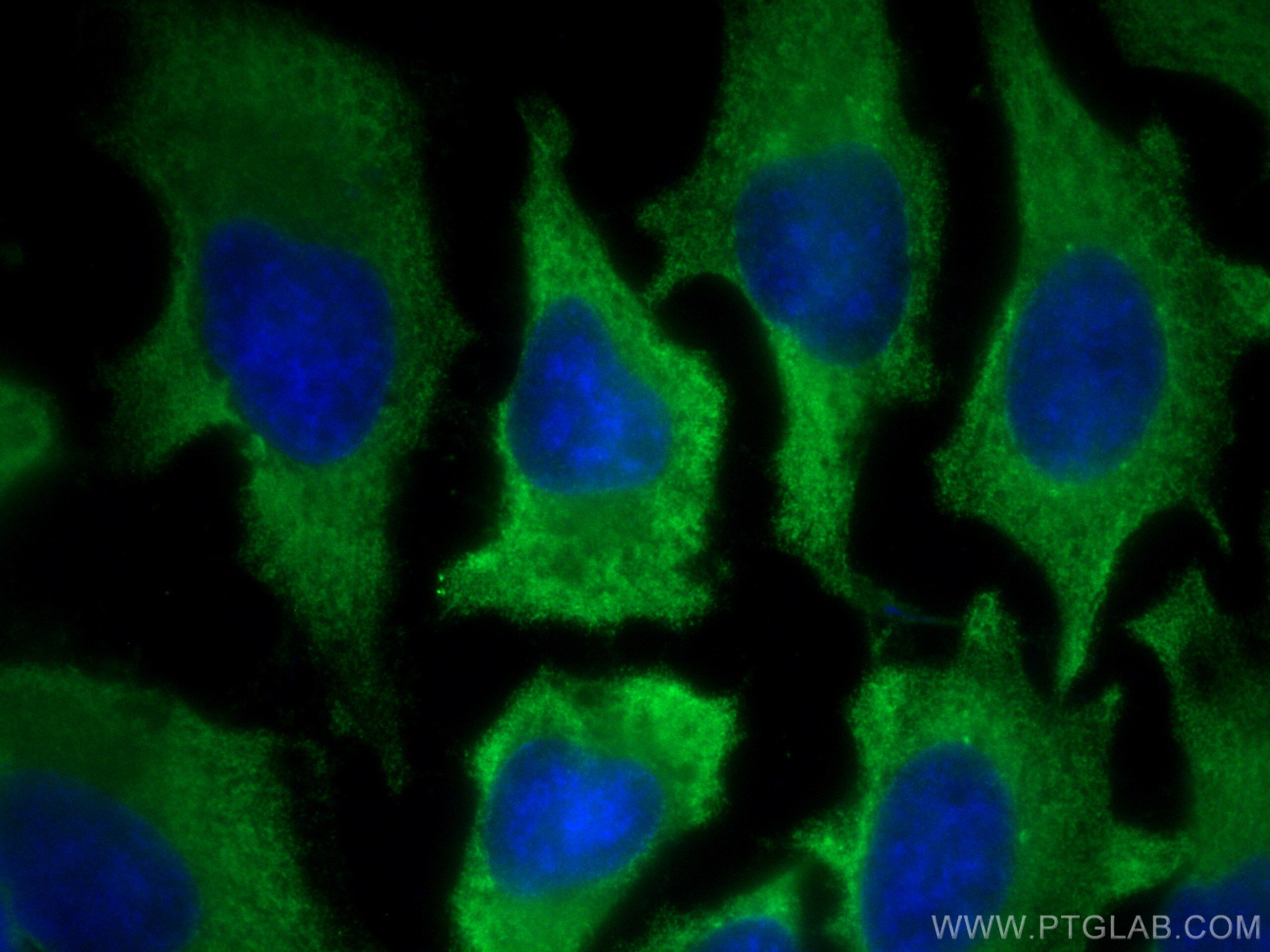 IF Staining of HeLa using 60312-1-Ig