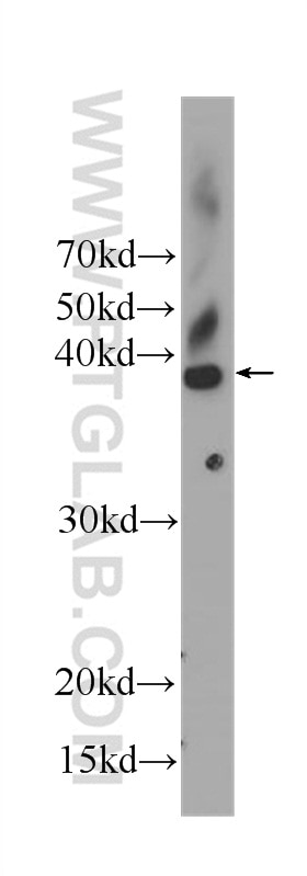 Western Blot (WB) analysis of K-562 cells using CDK2 Monoclonal antibody (60312-1-Ig)