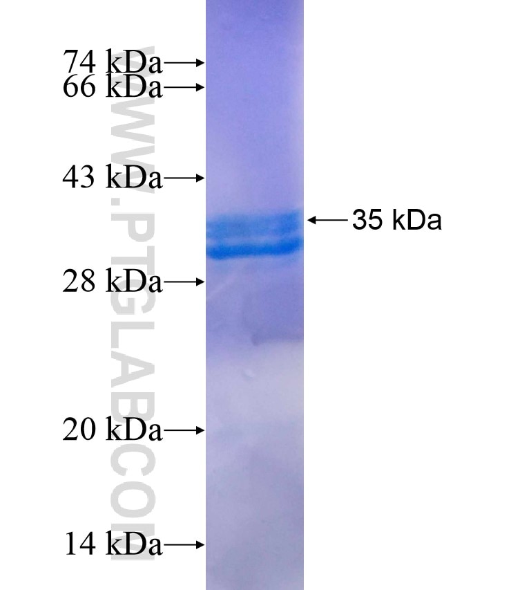 CDK2 fusion protein Ag17133 SDS-PAGE