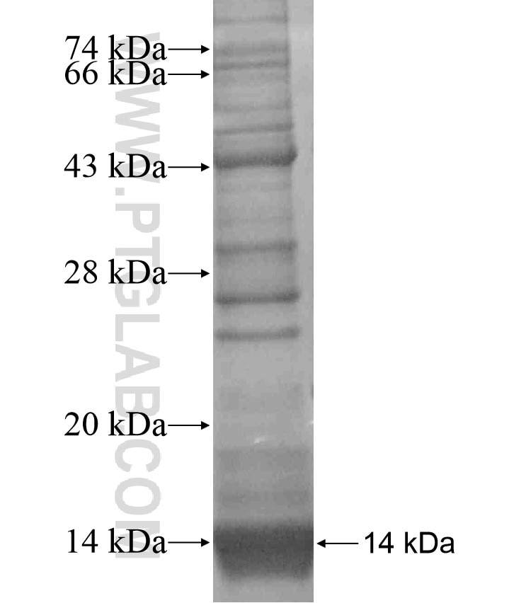 CDK2 fusion protein Ag17636 SDS-PAGE