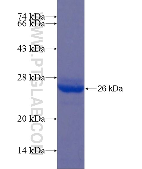 CDK2 fusion protein Ag21310 SDS-PAGE