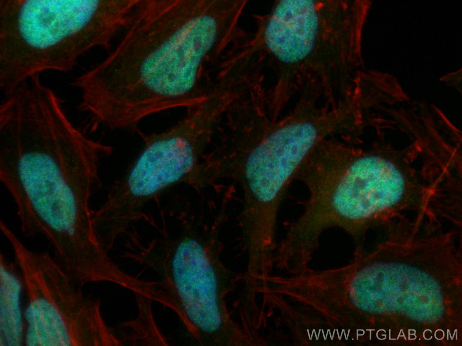 Immunofluorescence (IF) / fluorescent staining of HeLa cells using CDK2AP1 Polyclonal antibody (13060-2-AP)