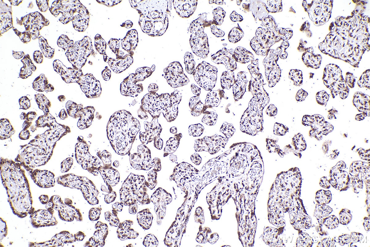 Immunohistochemistry (IHC) staining of human placenta tissue using CDK2AP1 Polyclonal antibody (13060-2-AP)