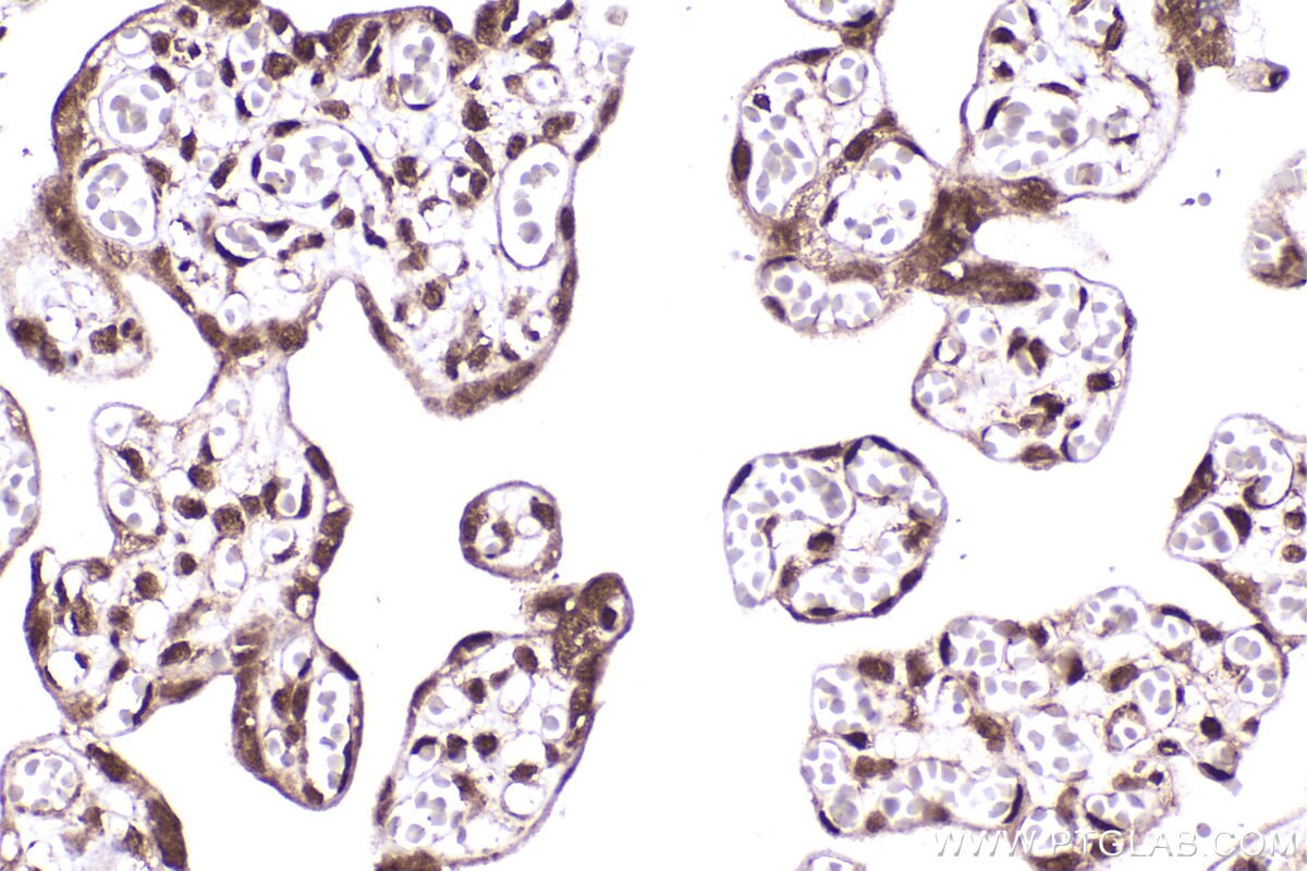 Immunohistochemistry (IHC) staining of human placenta tissue using CDK2AP1 Polyclonal antibody (13060-2-AP)