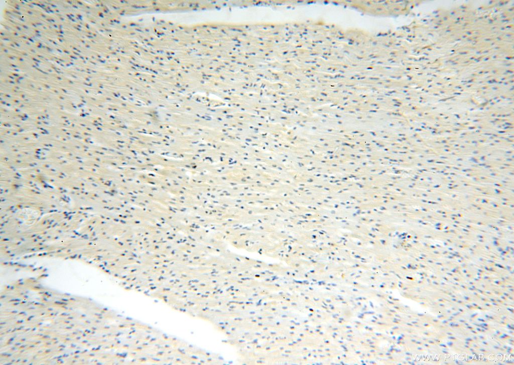 IHC staining of human heart using 13060-2-AP