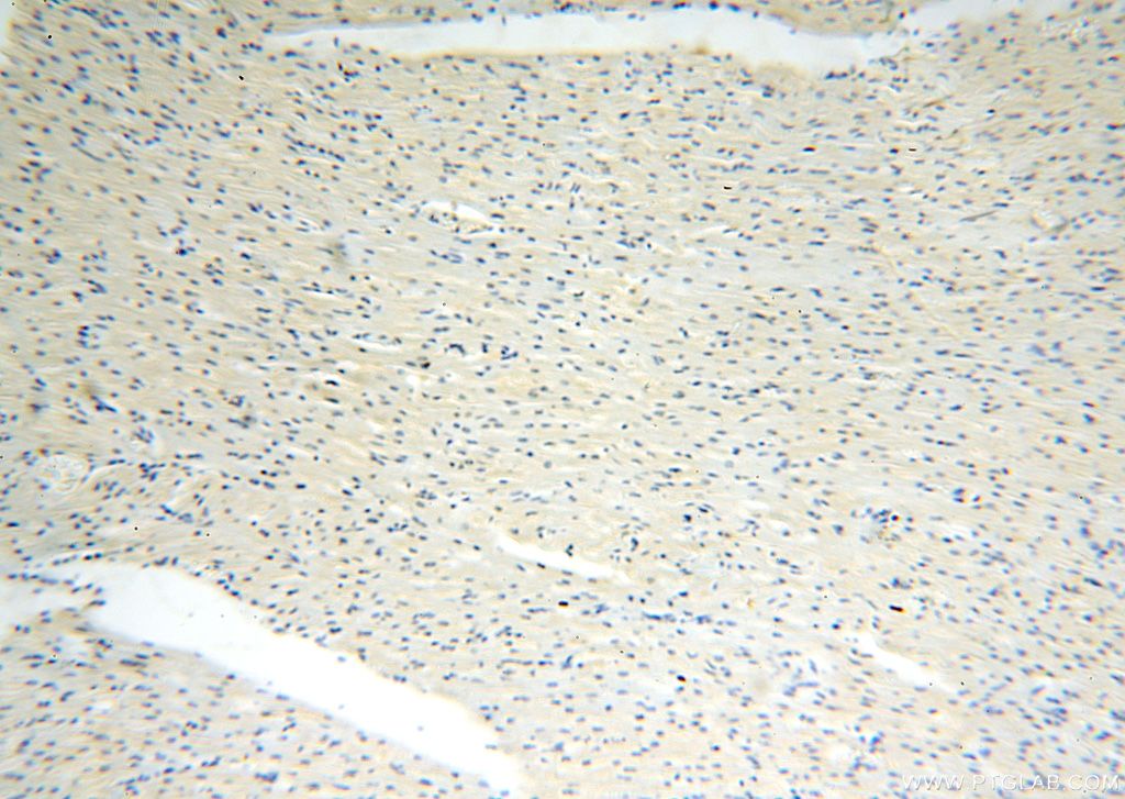 Immunohistochemistry (IHC) staining of human heart tissue using CDK2AP1 Polyclonal antibody (13060-2-AP)