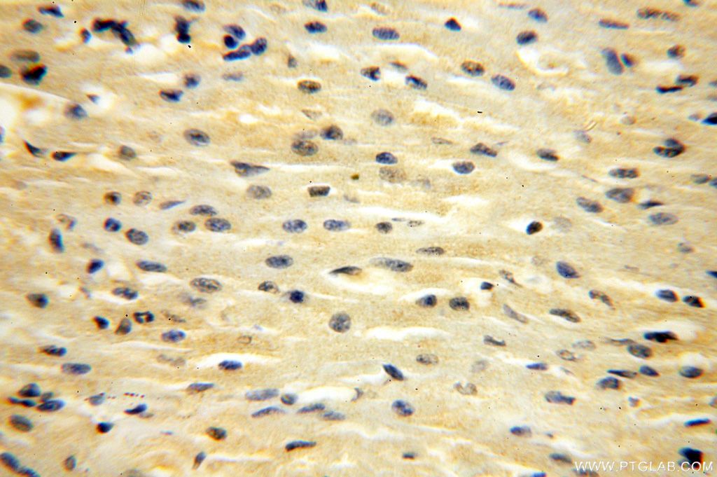 Immunohistochemistry (IHC) staining of human heart tissue using CDK2AP1 Polyclonal antibody (13060-2-AP)