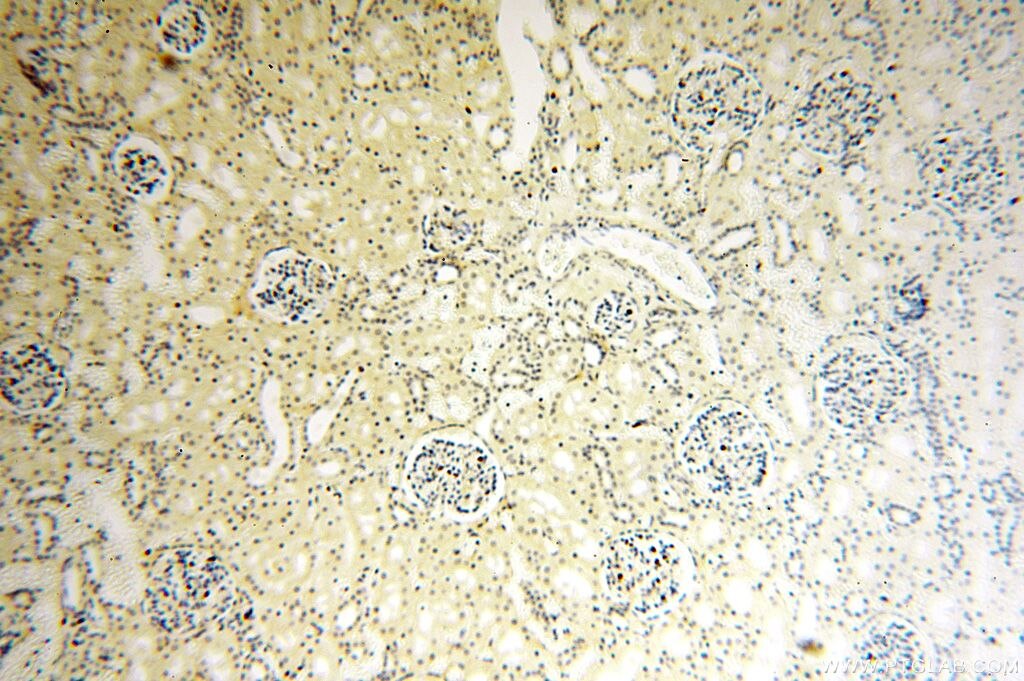 CDK2AP1