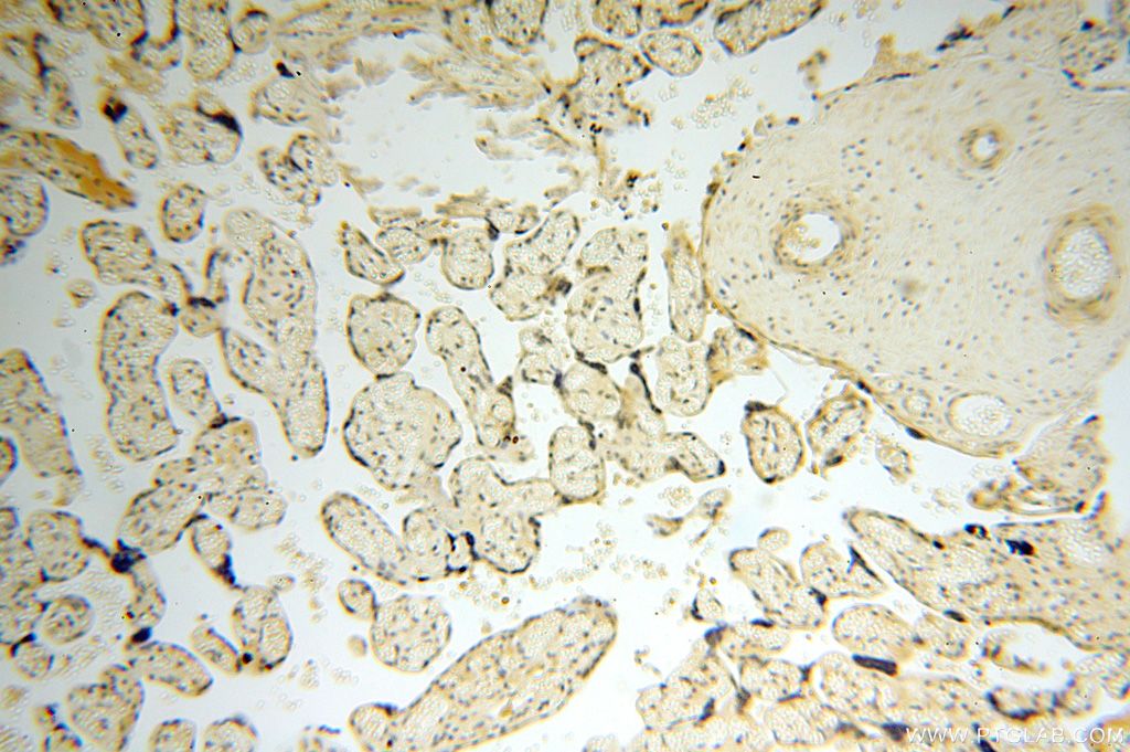 Immunohistochemistry (IHC) staining of human placenta tissue using CDK2AP1 Polyclonal antibody (13060-2-AP)