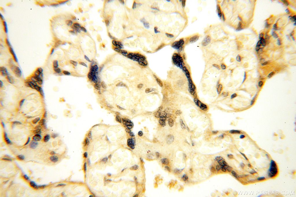 Immunohistochemistry (IHC) staining of human placenta tissue using CDK2AP1 Polyclonal antibody (13060-2-AP)