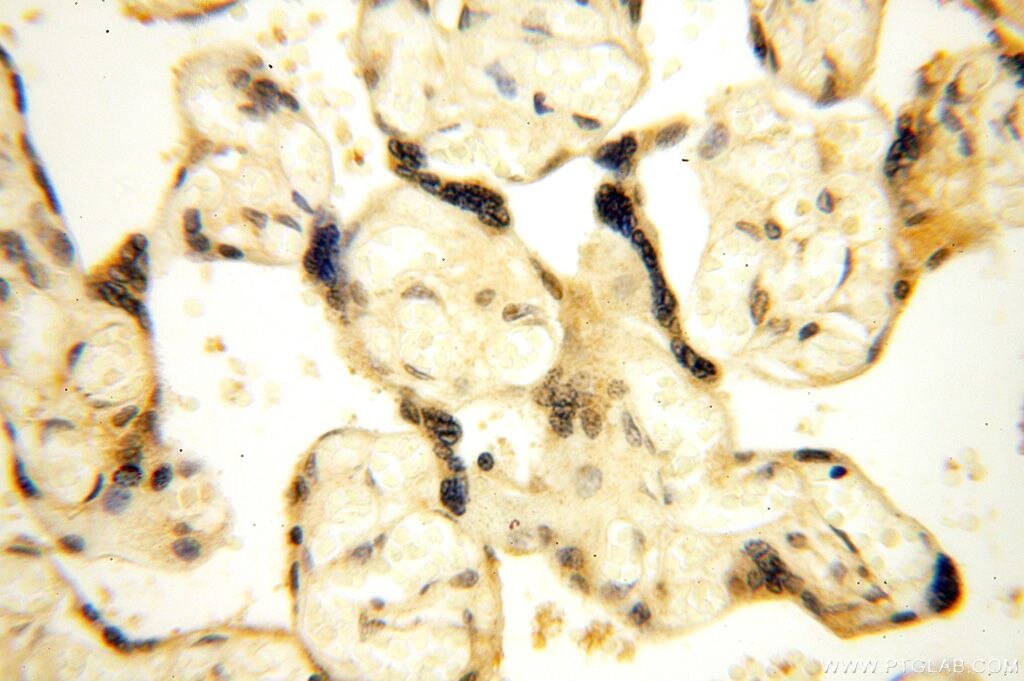 IHC staining of human placenta using 13060-2-AP