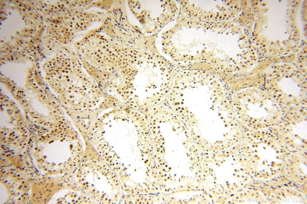 Immunohistochemistry (IHC) staining of human testis tissue using CDK2AP1 Polyclonal antibody (13060-2-AP)