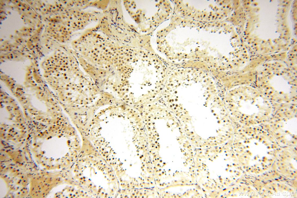 Immunohistochemistry (IHC) staining of human testis tissue using CDK2AP1 Polyclonal antibody (13060-2-AP)