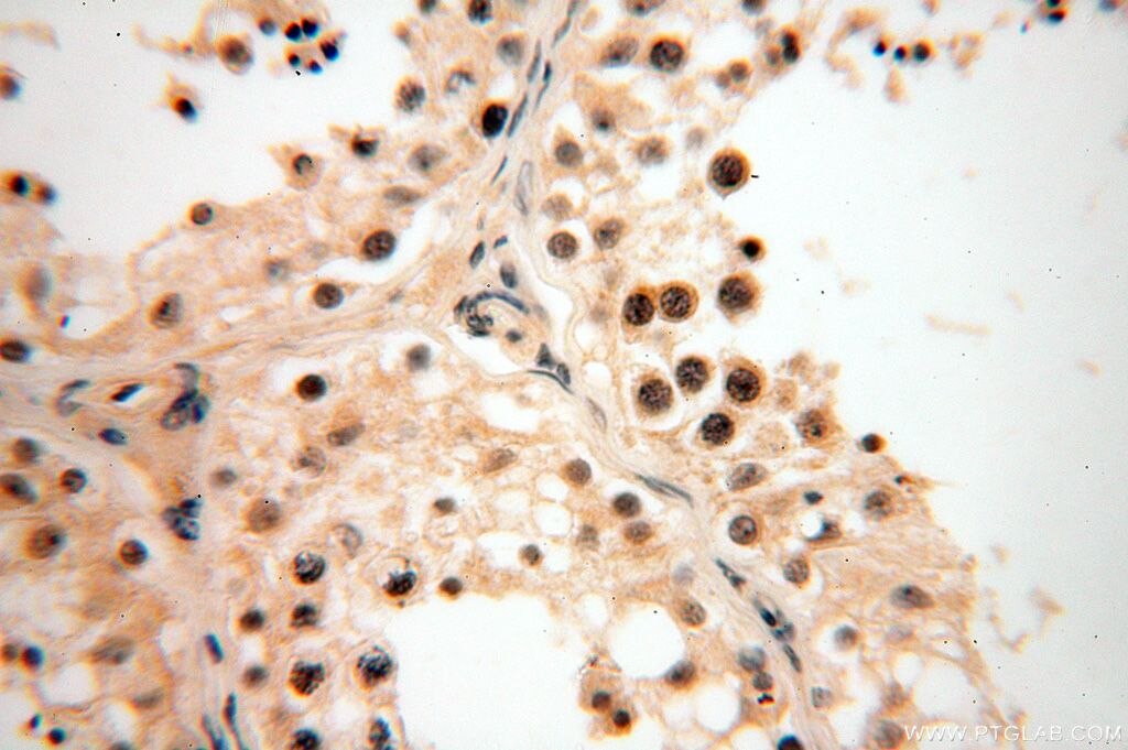 Immunohistochemistry (IHC) staining of human testis tissue using CDK2AP1 Polyclonal antibody (13060-2-AP)