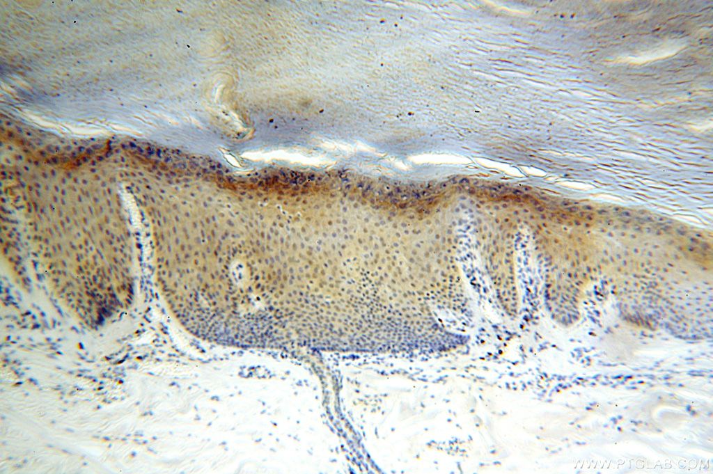 Immunohistochemistry (IHC) staining of human skin tissue using CDK2AP1 Polyclonal antibody (13060-2-AP)