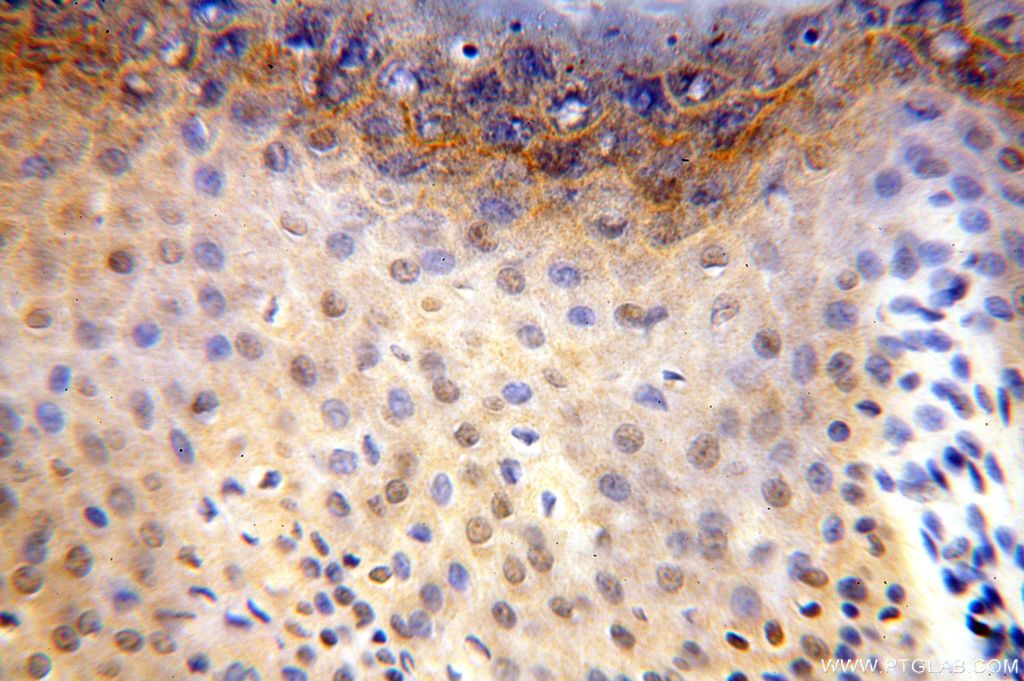 Immunohistochemistry (IHC) staining of human skin tissue using CDK2AP1 Polyclonal antibody (13060-2-AP)