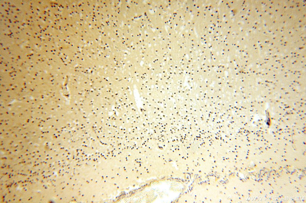 Immunohistochemistry (IHC) staining of human brain tissue using CDK2AP1 Polyclonal antibody (13060-2-AP)