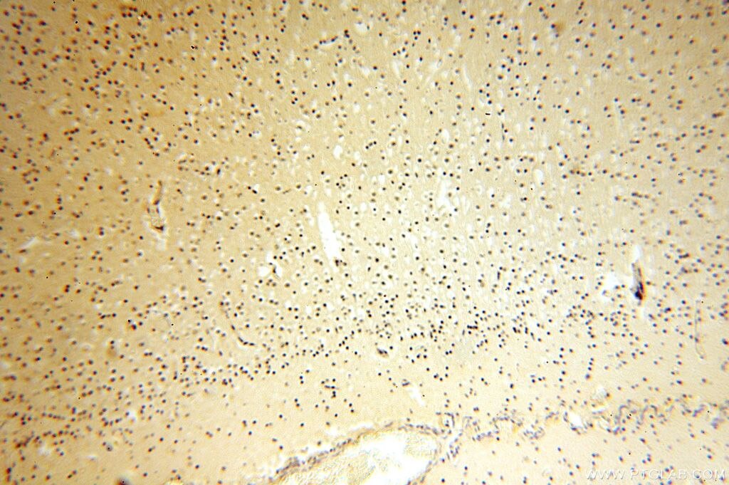 Immunohistochemistry (IHC) staining of human brain tissue using CDK2AP1 Polyclonal antibody (13060-2-AP)