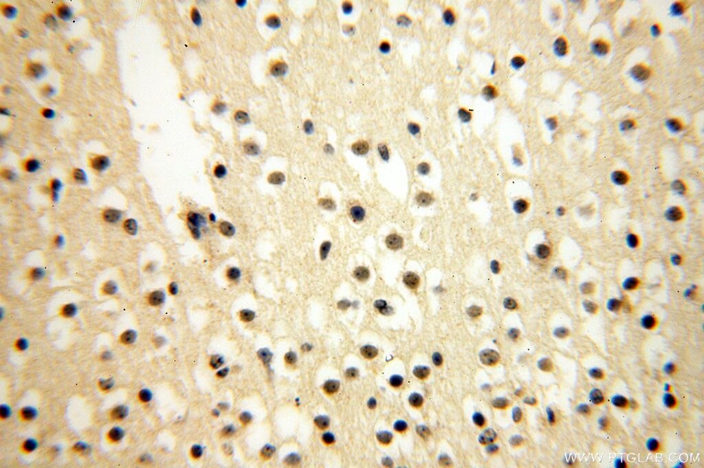 Immunohistochemistry (IHC) staining of human brain tissue using CDK2AP1 Polyclonal antibody (13060-2-AP)