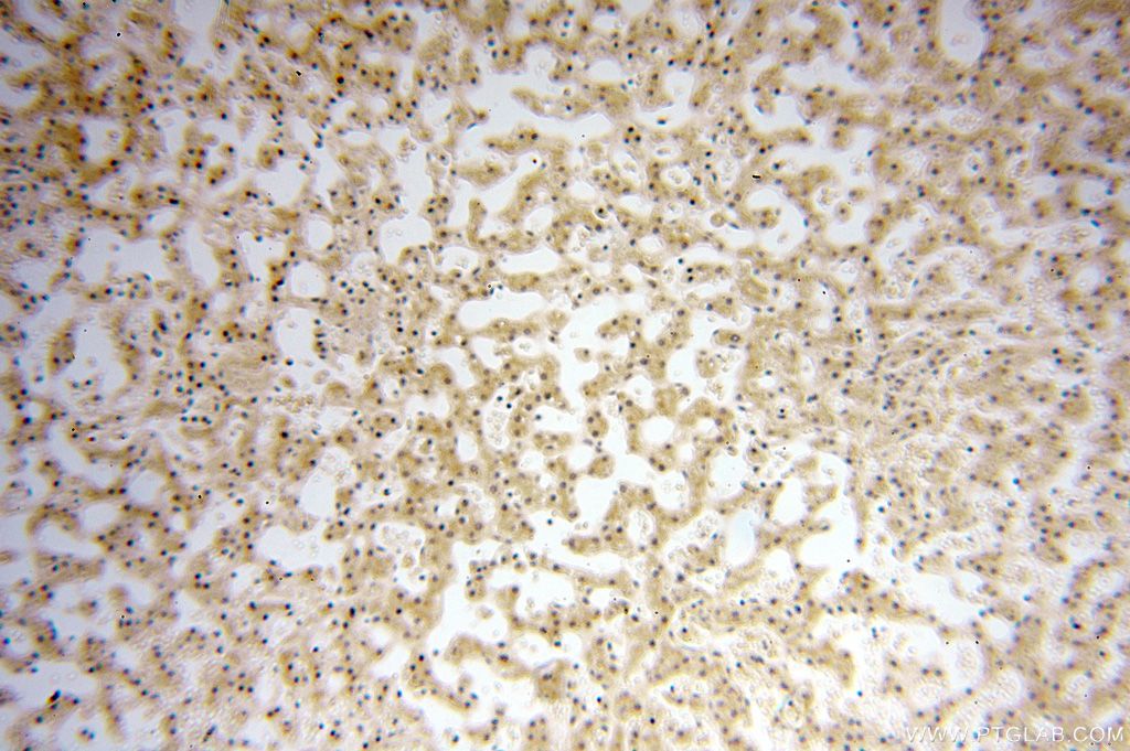 Immunohistochemistry (IHC) staining of human liver tissue using CDK2AP1 Polyclonal antibody (13060-2-AP)