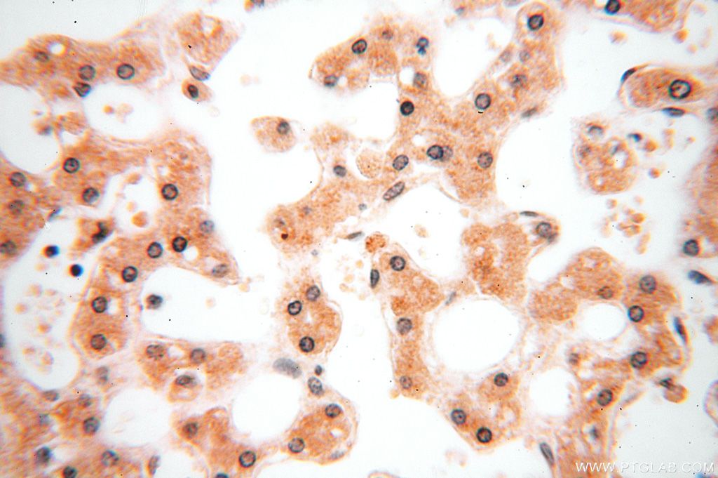 Immunohistochemistry (IHC) staining of human liver tissue using CDK2AP1 Polyclonal antibody (13060-2-AP)