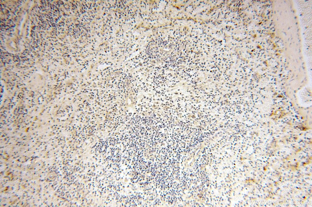 Immunohistochemistry (IHC) staining of human spleen tissue using CDK2AP1 Polyclonal antibody (13060-2-AP)