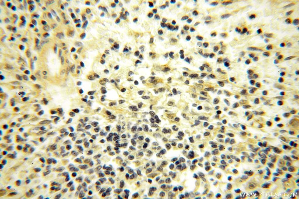 Immunohistochemistry (IHC) staining of human spleen tissue using CDK2AP1 Polyclonal antibody (13060-2-AP)