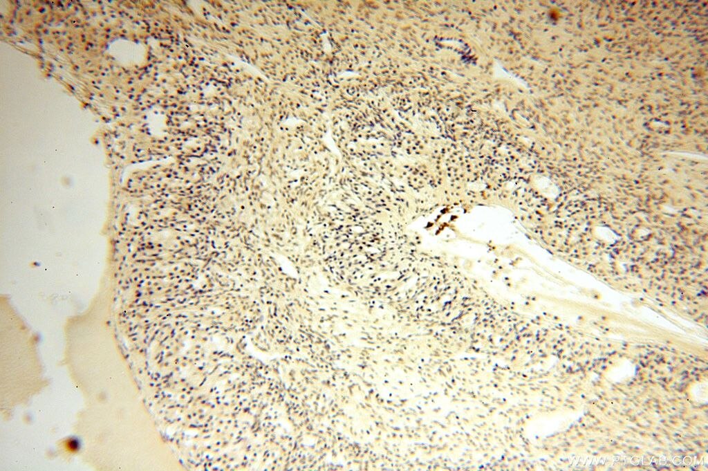 Immunohistochemistry (IHC) staining of human ovary tissue using CDK2AP1 Polyclonal antibody (13060-2-AP)