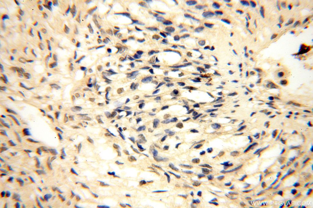 Immunohistochemistry (IHC) staining of human ovary tissue using CDK2AP1 Polyclonal antibody (13060-2-AP)