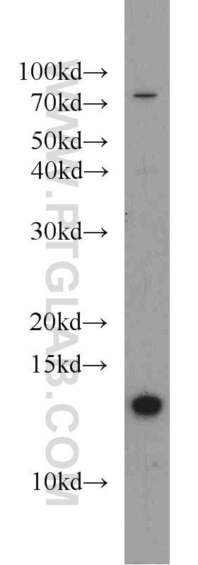 Western Blot (WB) analysis of HEK-293 cells using CDK2AP1 Polyclonal antibody (13060-2-AP)