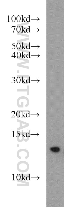 Western Blot (WB) analysis of HeLa cells using CDK2AP1 Polyclonal antibody (13060-2-AP)