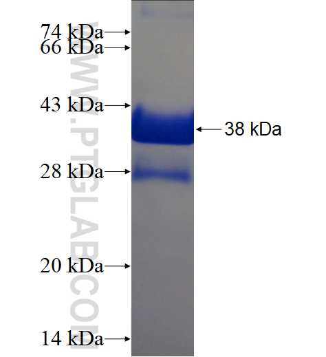CDK2AP1 fusion protein Ag3736 SDS-PAGE