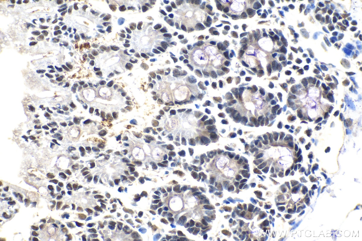 IHC staining of mouse intestine using 15423-1-AP Immunohistochemistry (IHC) staining of mouse intestine using CDK2AP2 Polyclonal antibody (15423-1-AP)
