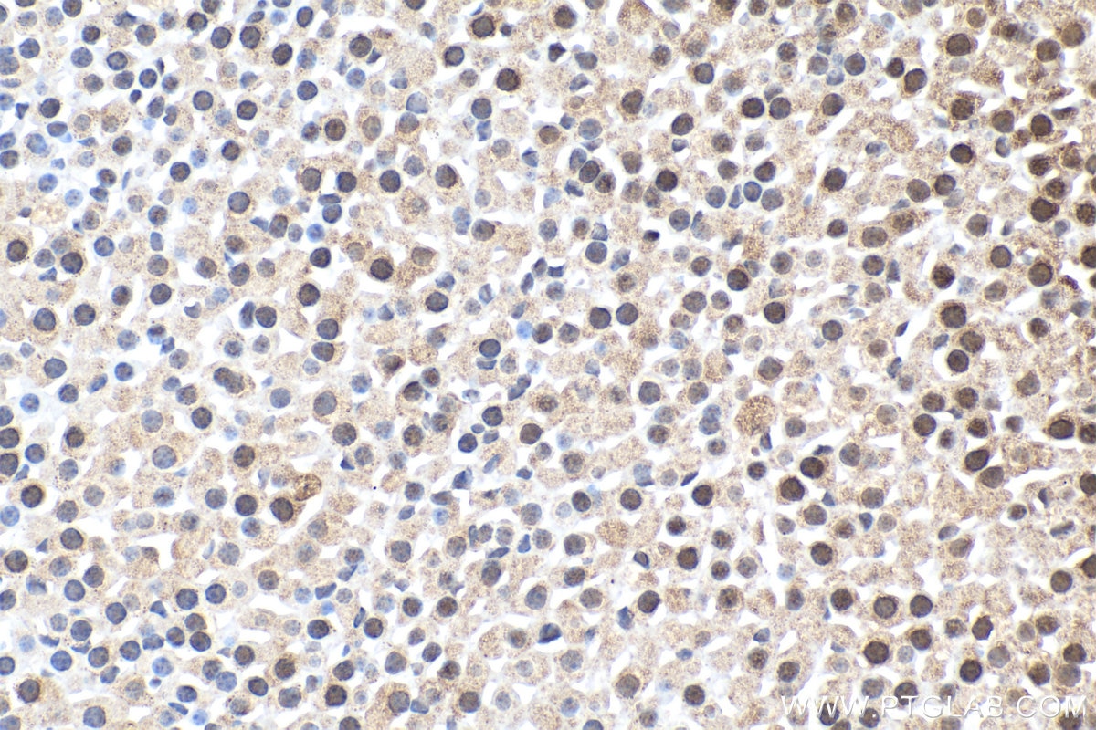 IHC staining of mouse adrenal gland using 15423-1-AP Immunohistochemistry (IHC) staining of mouse adrenal gland tissue using CDK2AP2 Polyclonal antibody (15423-1-AP)