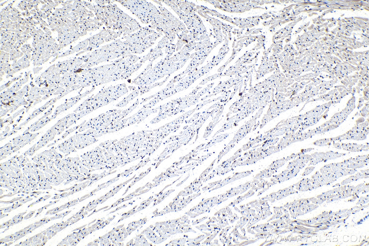 IHC staining of mouse heart using 15423-1-AP Immunohistochemistry (IHC) staining of mouse heart tissue using CDK2AP2 Polyclonal antibody (15423-1-AP)