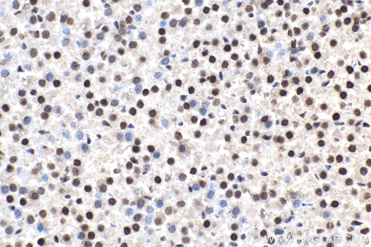 IHC staining of rat adrenal gland using 15423-1-AP Immunohistochemistry (IHC) staining of rat adrenal gland tissue using CDK2AP2 Polyclonal antibody (15423-1-AP)